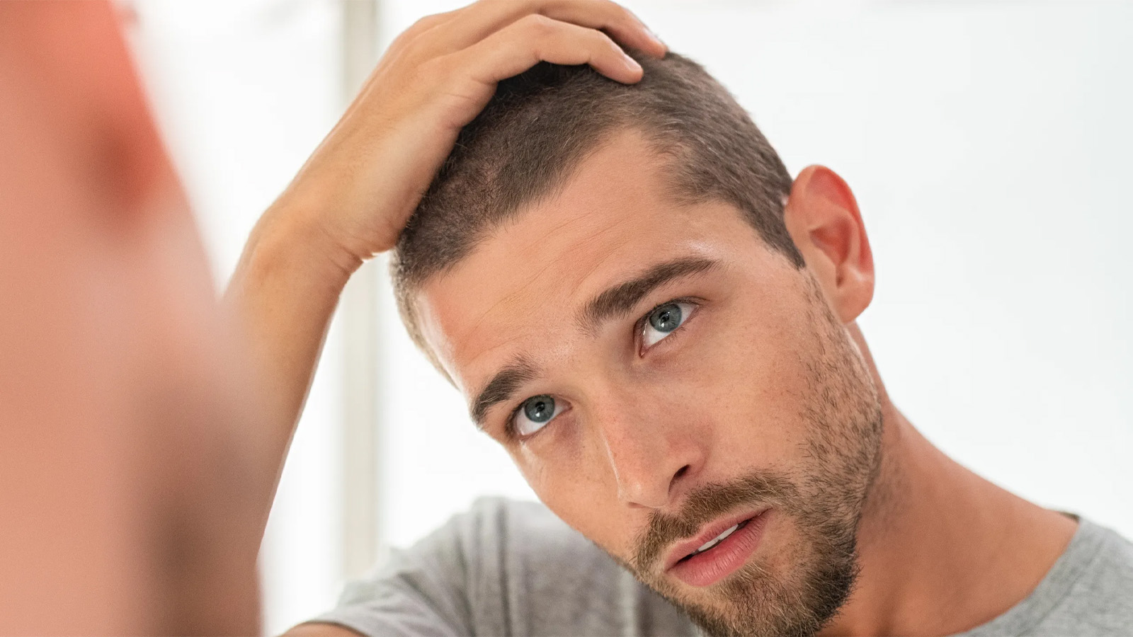 د‌ر‌د کف سر و ر‌یشه مو