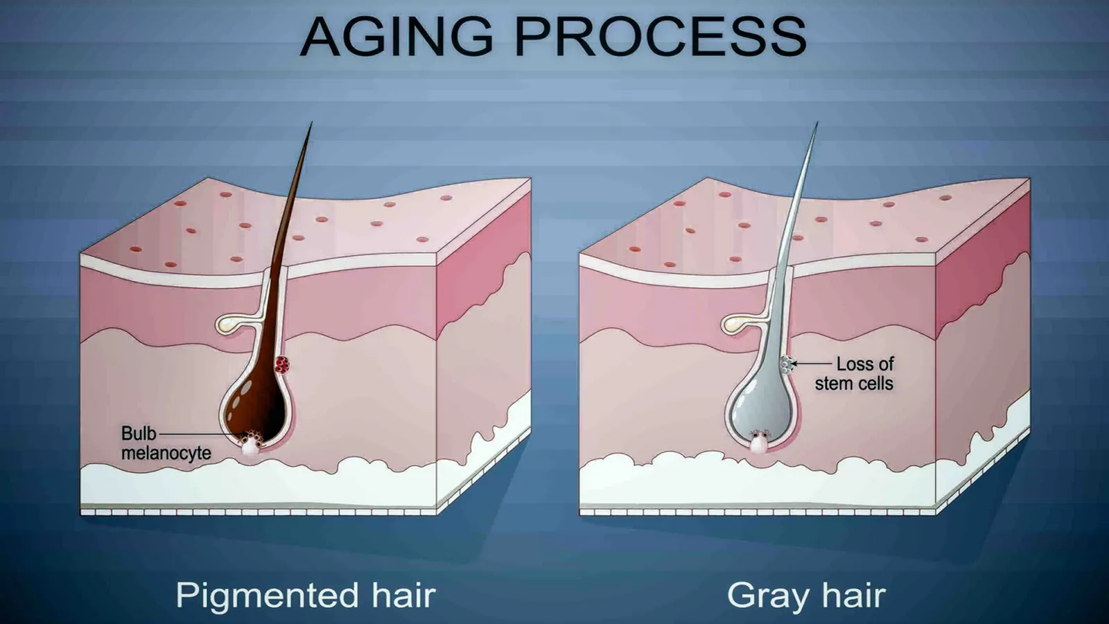سفید شدن مو از ریشه یا ساقه