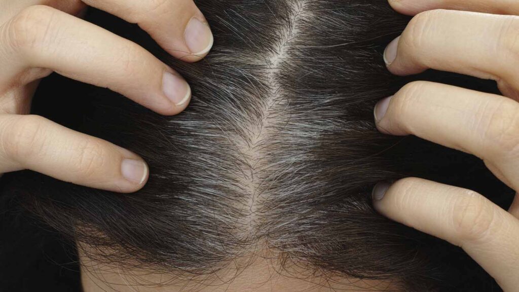 مو از ریشه سفید میشه یا ساقه