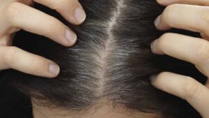 مو از ریشه سفید میشه یا ساقه