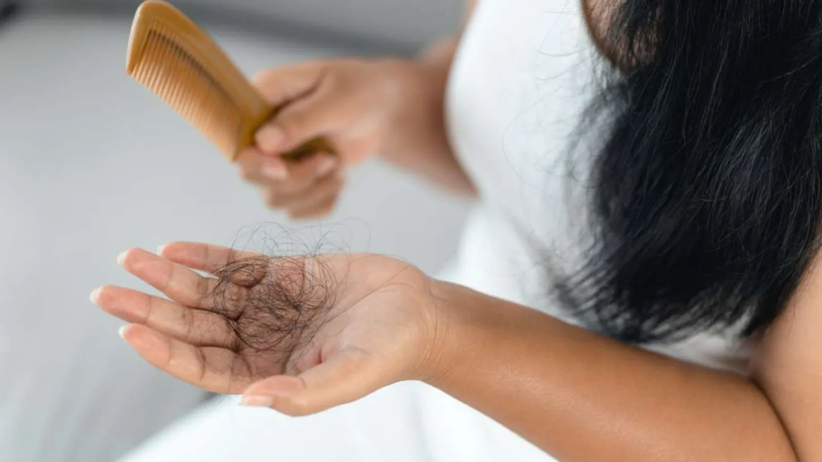 دلیل ریزش مو جلوی سر زنان