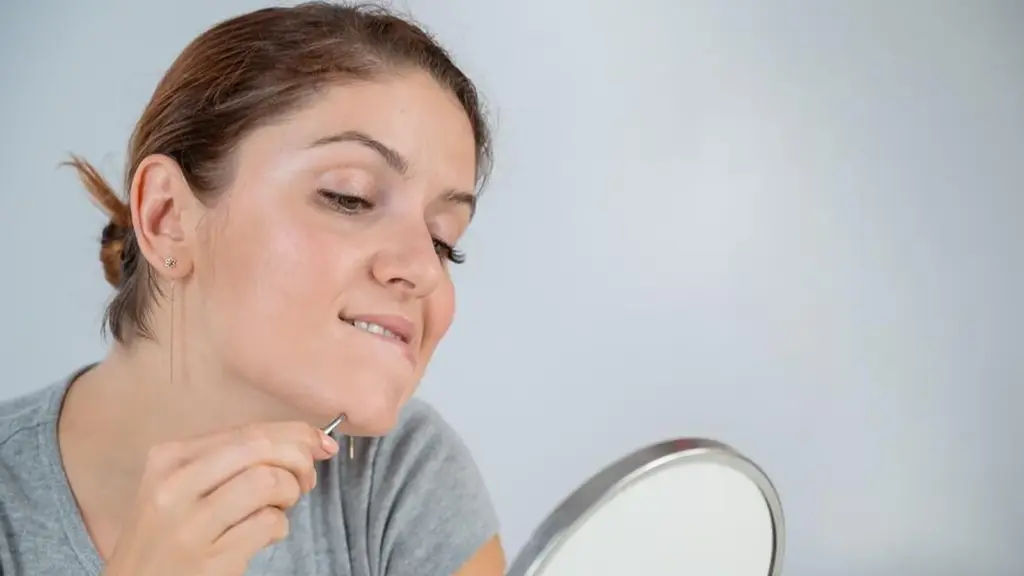 موهای زائد چانه در زنان