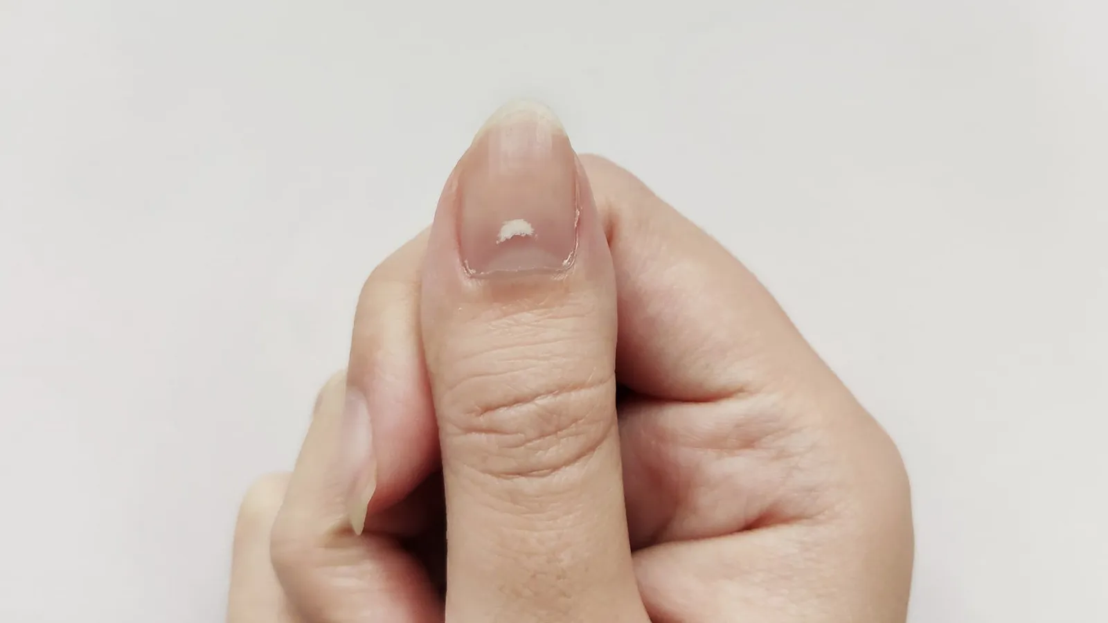  علت لكه سفيد روى ناخن يا لكه سفيد روى ناخن نشانه جيست