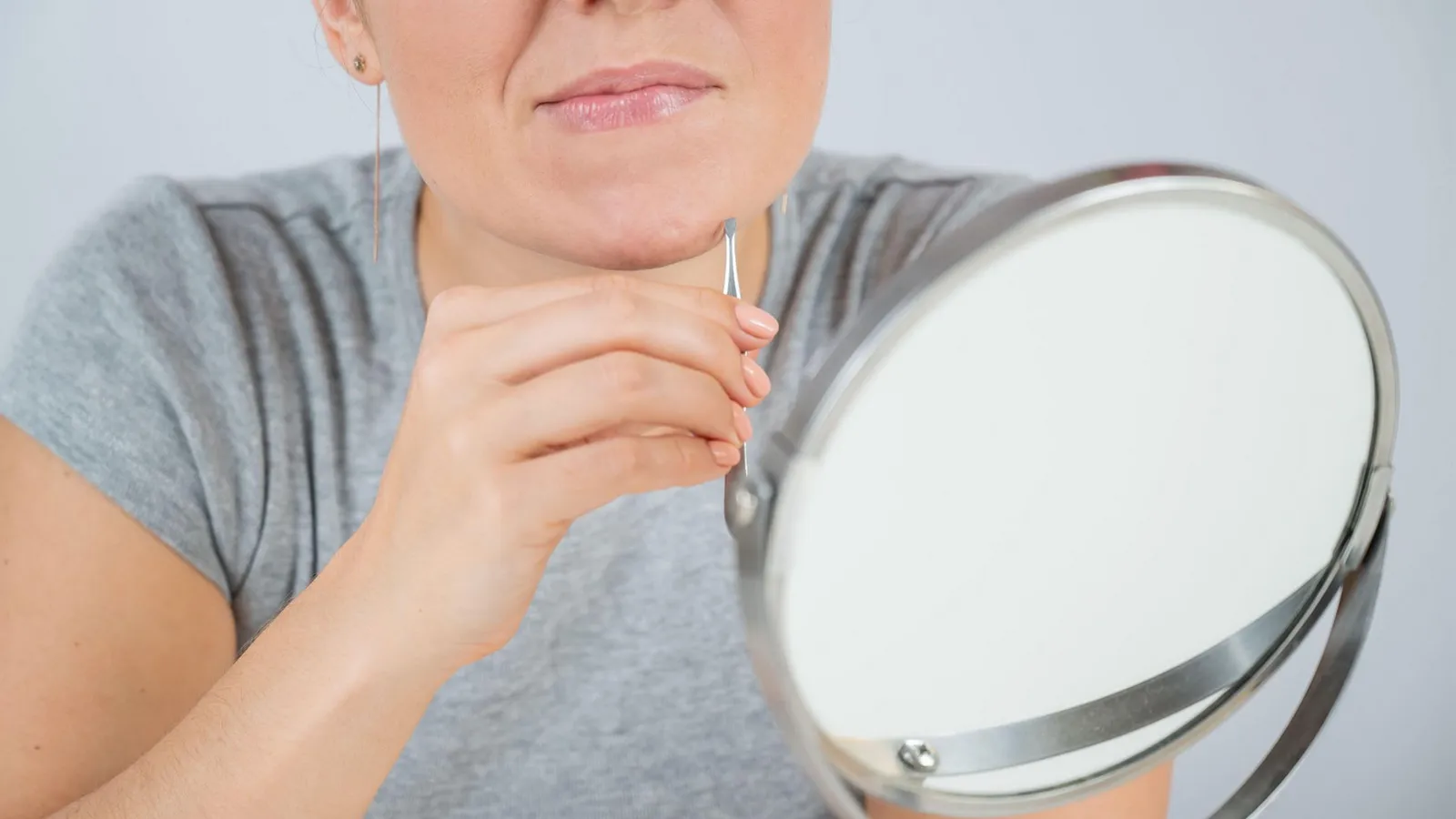 علت موهاى زائد زير چانه در زنان