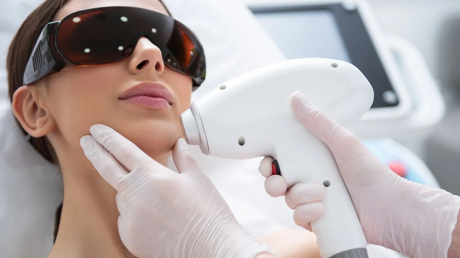 علت موهای زائد زیر چانه در زنان چیست؟