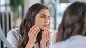 علت موهاى زائد زير چانه