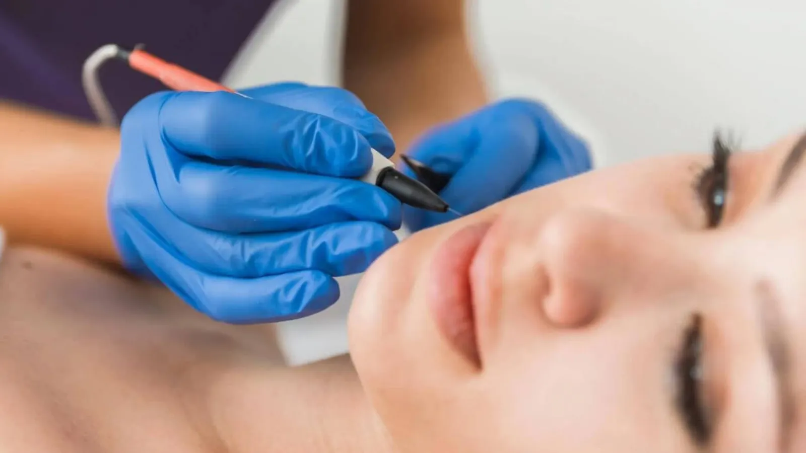 علت موهاى زائد زير چانه در زنان