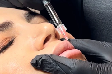 تزریق ژل رودهن