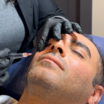 تزریق چربی  آذربایجان غربی