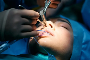 جراحی زیبایی بینی  آذربایجان غربی