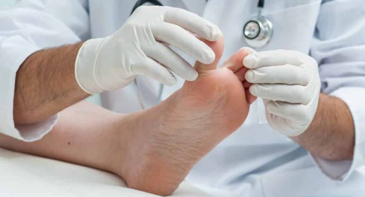 بهترین درمان زخم دیابتی  آذربایجان غربی