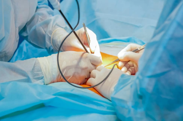 لاپاراسکوپی  آذربایجان غربی