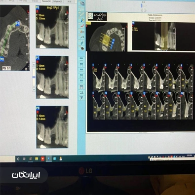 رادیولوژی فک و صورت دکتر افقهی