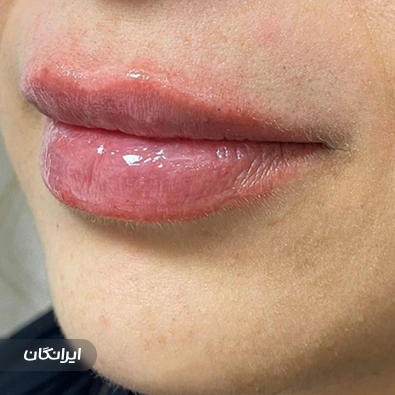 کلینیک پوست و مو و زیبایی لیزا