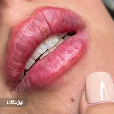 مرکز پوست و لیزر آویژه