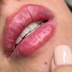 مرکز پوست و لیزر آویژه