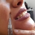 مرکز پوست و لیزر آویژه