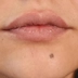 کلینیک زیبایی پریسان پونک