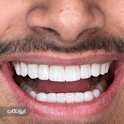دندانپزشکی پارسیان