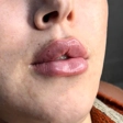 کلینیک زیبایی و لیزر رز