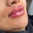 کلینیک زیبایی و لیزر رز