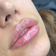 کلینیک زیبایی و لیزر رز