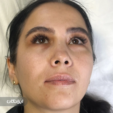 مرکز زیبایی و لیزر نورا