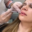 کلینیک زیبایی بلا