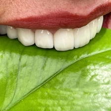 دندانپزشکی آرامیس
