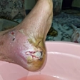 درمانگر زخم فرید راستگو