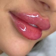 کلینیک زیبایی مینوسا
