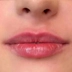 مرکز زیبایی و لیزر آیسونا