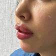کلینیک زیبایی دنیز