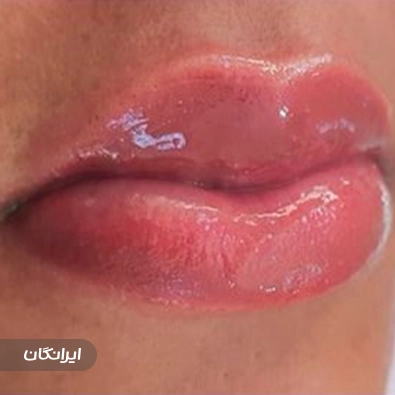 مرکز مراقبت پوستی احمدی