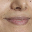 کلینیک زیبایی سینوهه