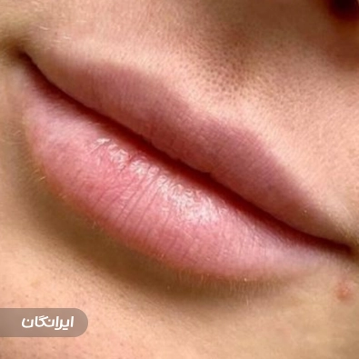 کلینیک زیبایی سینوهه