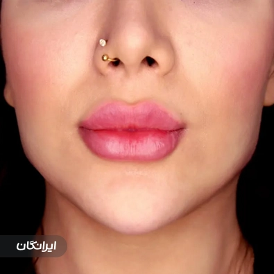 کلینیک زیبایی لاوین