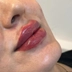 کلینیک زیبایی دکتر ایلقار رستمی
