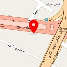 نرده اسپیرال