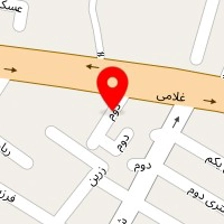 تعویض روغنی مغاری