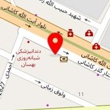 تشک برن