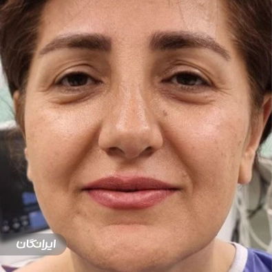 کلینیک جراحی ایران بیوتی