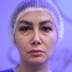 کلینیک زیبایی تاج