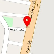 قصر روکش