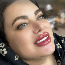 کلینیک زیبایی الا رز