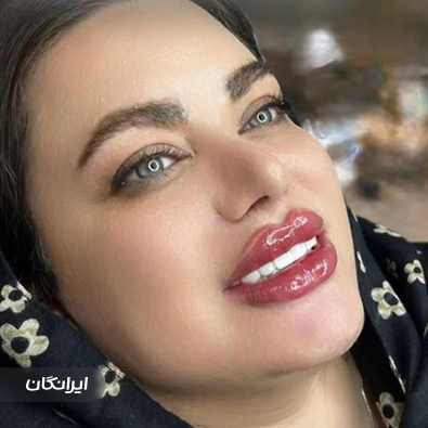 کلینیک زیبایی الا رز