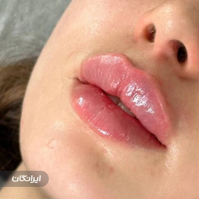 کلینیک زیبایی رامیلا