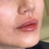 کلینیک زیبایی دکتر ریحانه احمدخانی