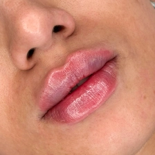کلینیک زیبایی نیستا