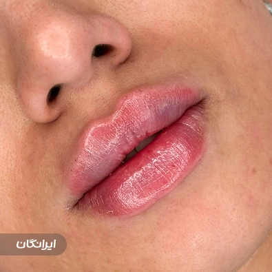 کلینیک زیبایی نیستا
